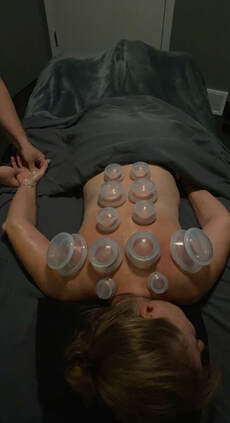 Massage Cupping Clearfield