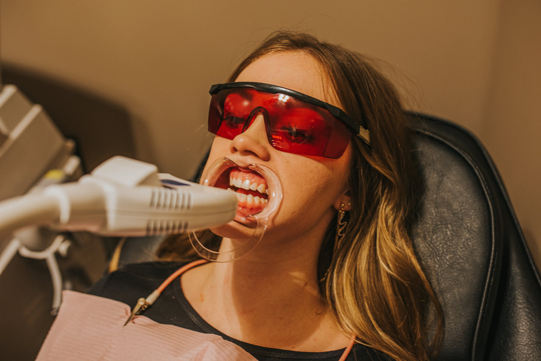 Teeth Whitening Clearfield